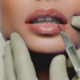 lip fillers worcester ma