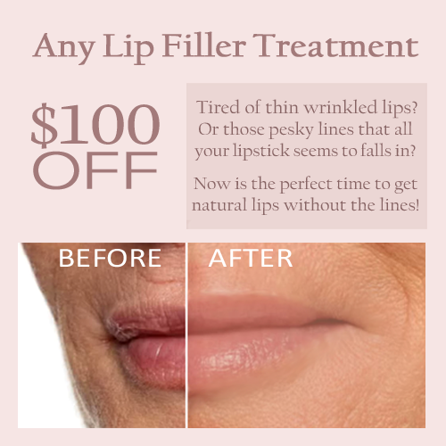 lip-filler worcester, ma lip-filler worcester, ma
