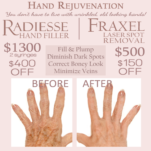 hand filler fraxel special