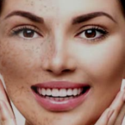 sun damage treatment